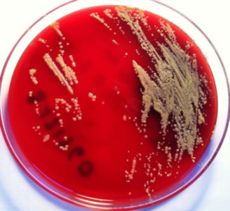 Encuentran-por-primera-vez-casos-de-infeccion-en-humanos-por-una-bacteria-del-suelo_image800_