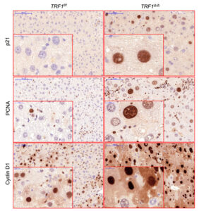 Los-telomeros-disfuncionales-pueden-estar-en-el-origen-de-enfermedades-hepaticas_image800_