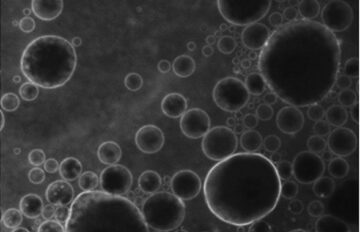 microburbujas-y-ultrasonidos-abren-la-barrera-del-cerebro-para-introducir-farmacos_image_380