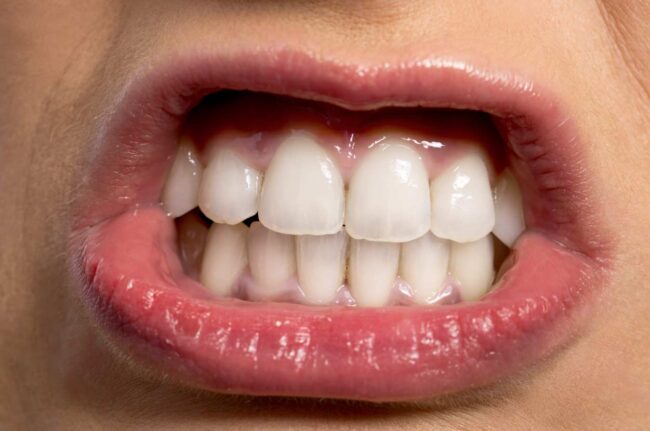 Soñar que se te caen los dientes: ¿qué significa?